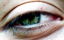 Alergia oculara